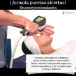 Neurocrioestimulación